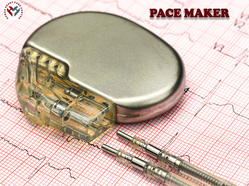 Pace maker Installation By Dr Merajul Haque