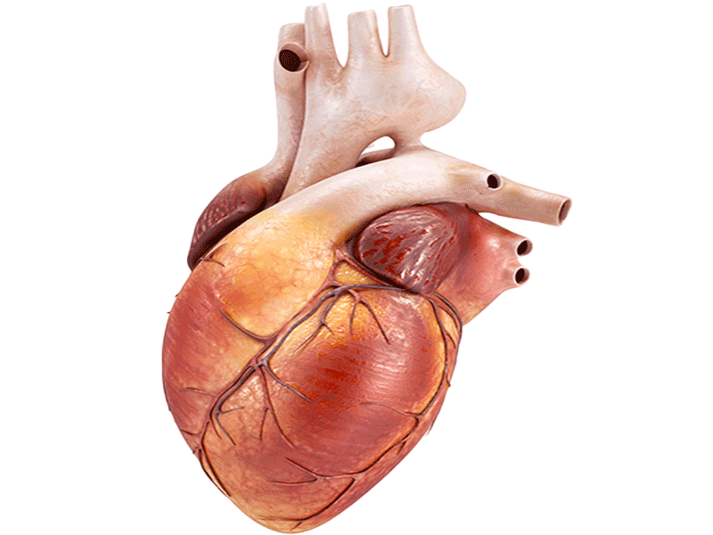 Coronary Angiography By Dr Merajul Haque
