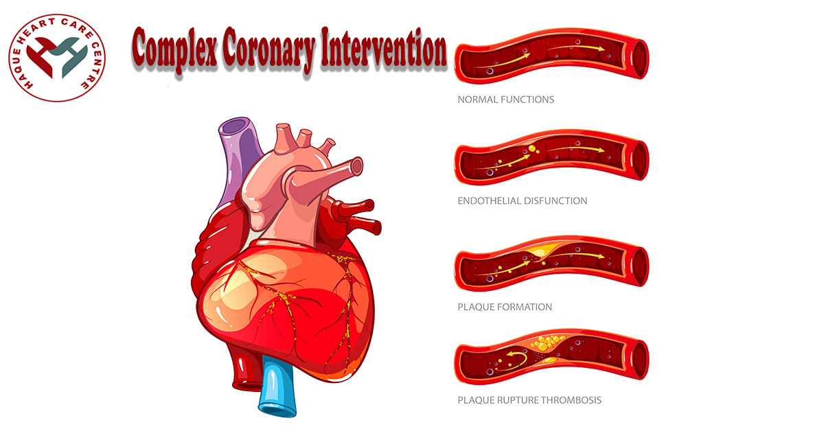 Complex Coronary Intervention