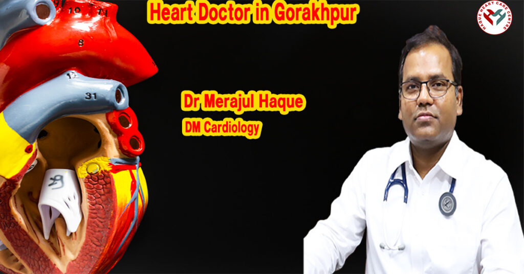 Heart Doctor in Gorakhpur
